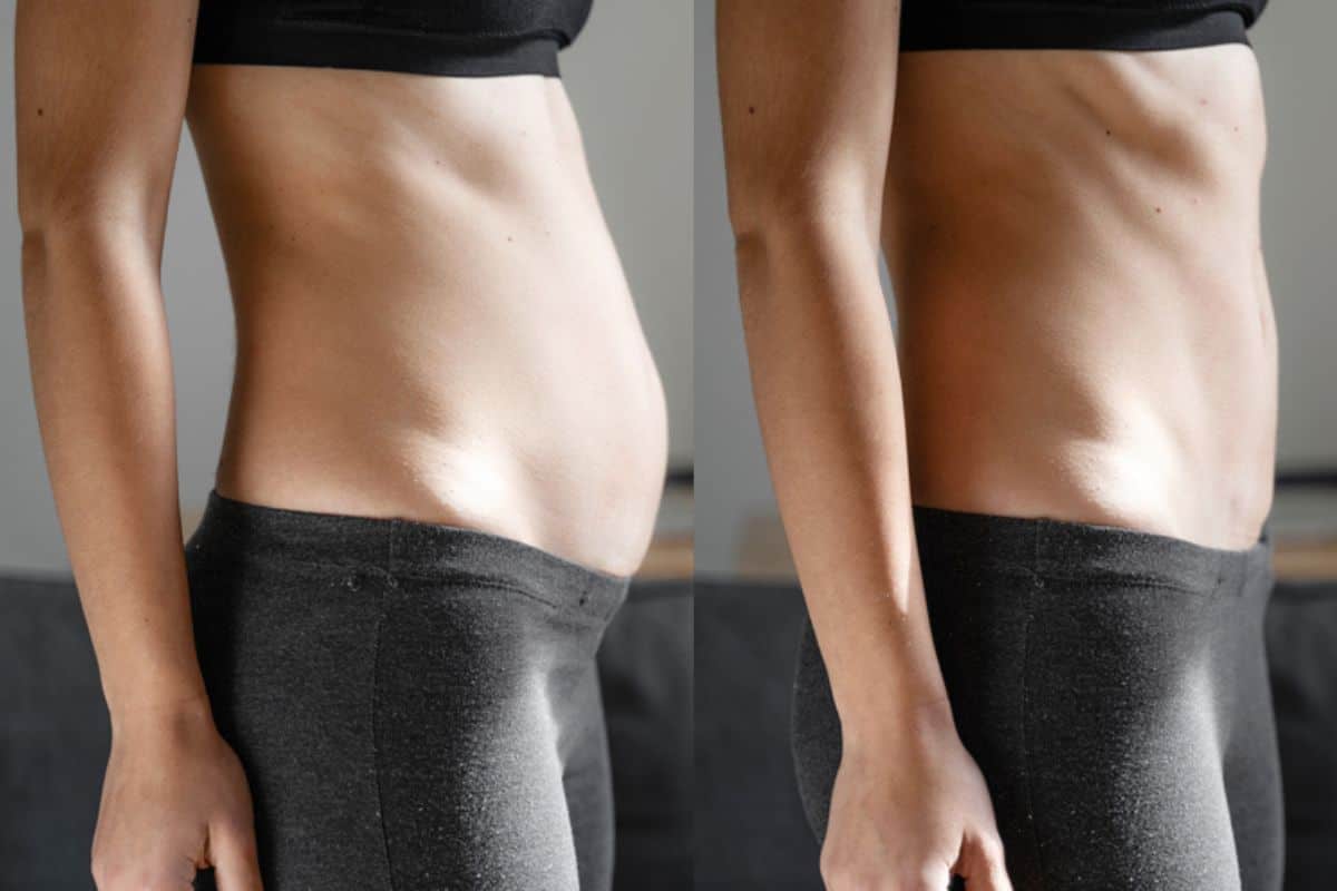 Post-Pregnancy: What Happens to Your Abdominal Muscles After Birth Cheshire