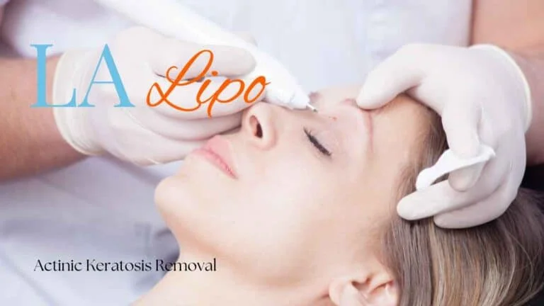 Woman receiving Actinic Keratosis Removal Treatment Cheshire