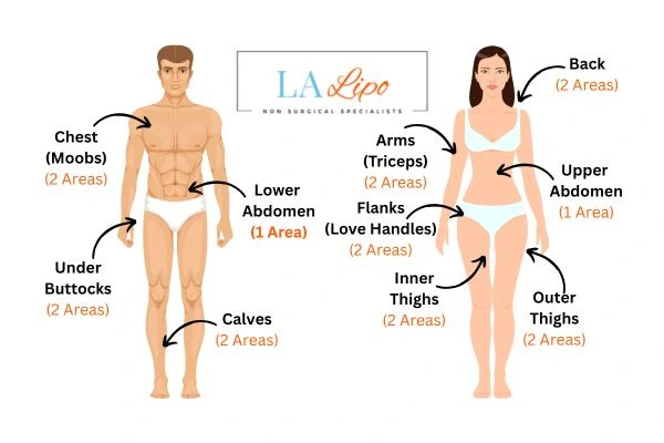 LA LIPO Cryolipolysis Areas Cheshire