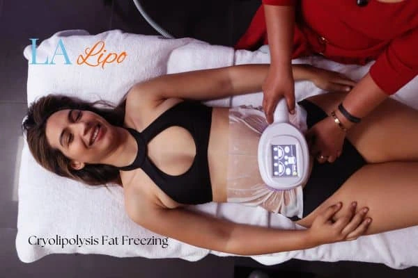 woman getting cryolipolysis Cheshire