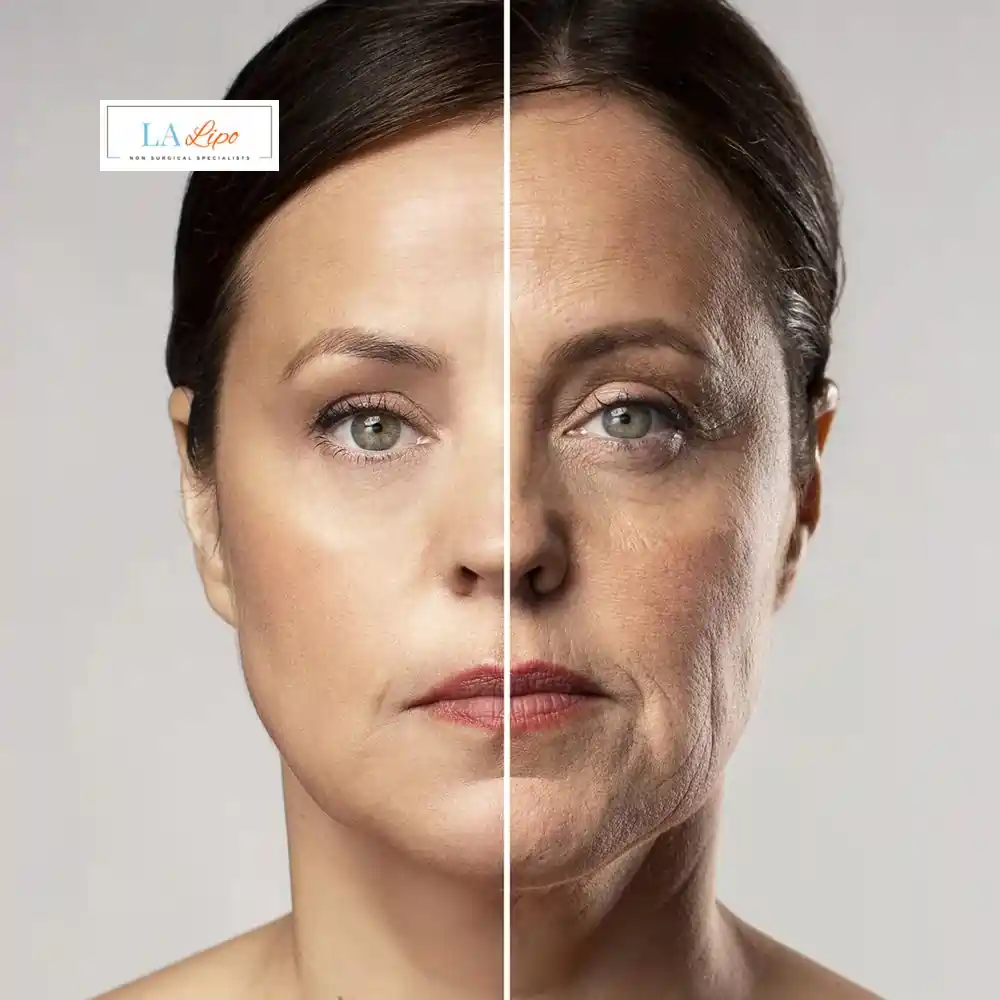 How Can You Tell If Non-Surgical Skin Tightening Is Right for You Cheshire?