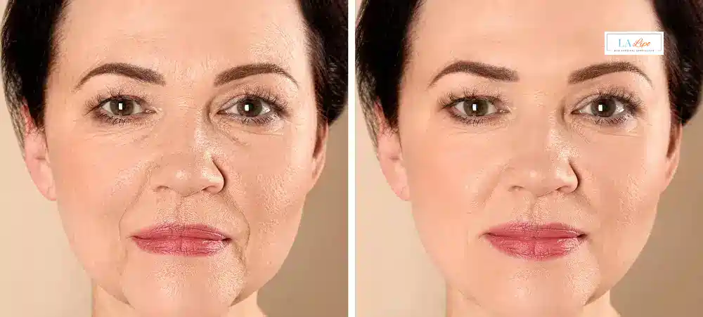 How Long Does It Take to See Results and How Long Do They Last Cheshire?