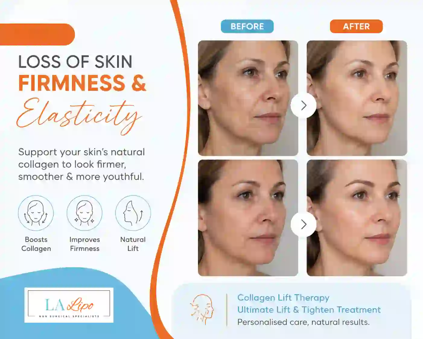 Sign #7: Loss of Skin Firmness and Elasticity Cheshire