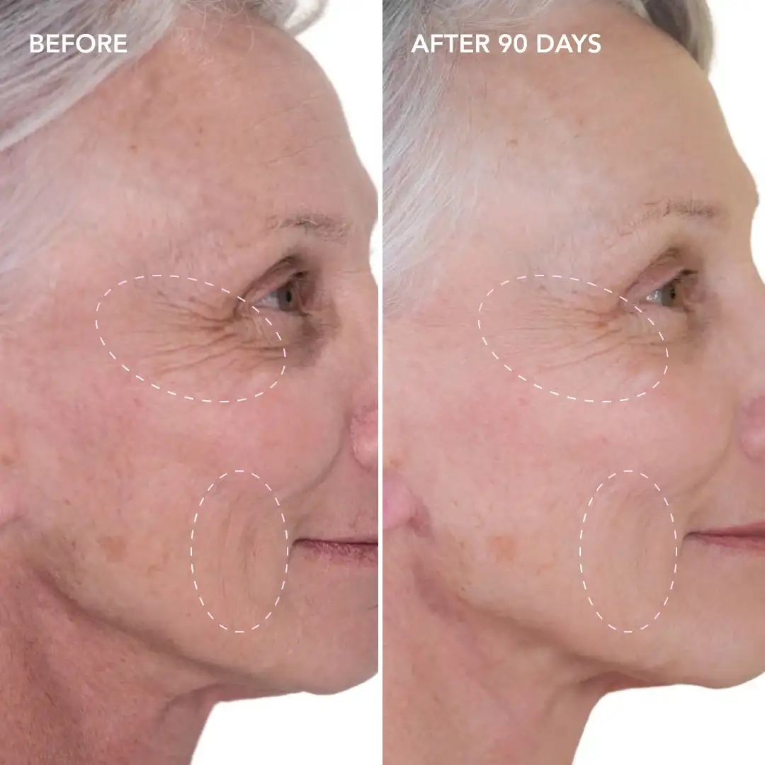 When will you see results Cheshire